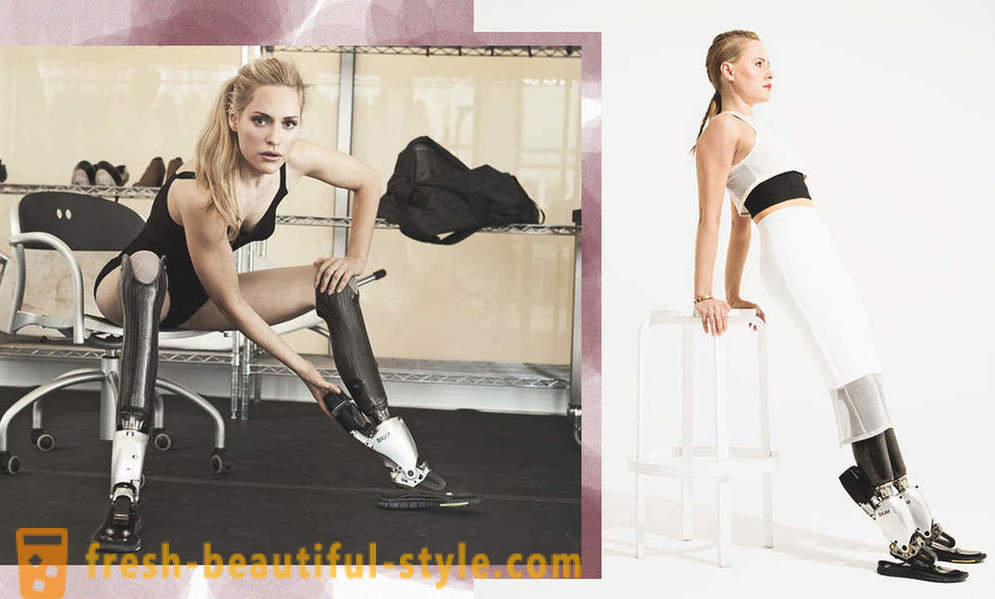 Uendelig skønhed: 6 kvindelige modeller med proteser