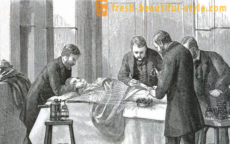 Chokerende fakta om den victorianske kirurgi