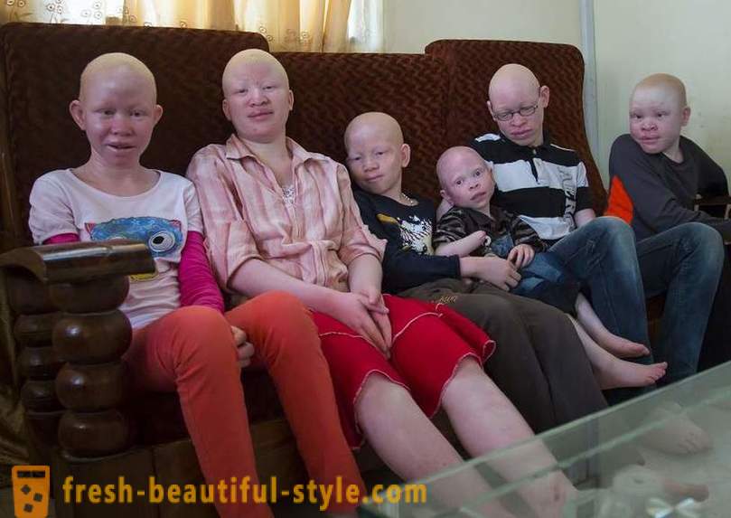 Den tragiske historie tanzanianske albinoer