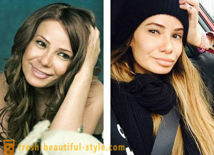 10 russiske skønheder før og efter plast