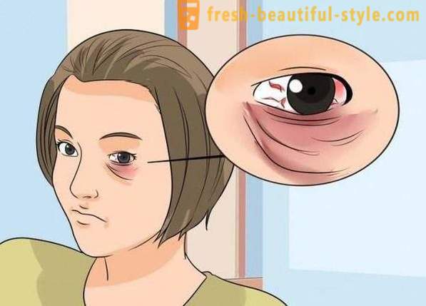 Hvordan at maskere et blåt øje fra et slag: kosmetik, især anbefalinger og