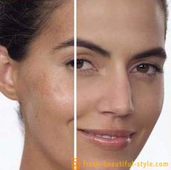 Whitening Cream af alder pletter i ansigtet: de vigtigste arter anmeldelser