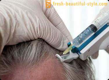 Mesotherapy for hår: Makeup værktøjer og kontraindikationer
