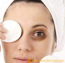 Rådgivning om, hvordan du fjerner mørke rande under øjnene